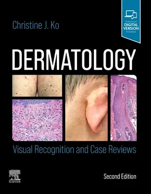 Bőrgyógyászat: Vizuális felismerés és esetismertetések - Dermatology: Visual Recognition and Case Reviews