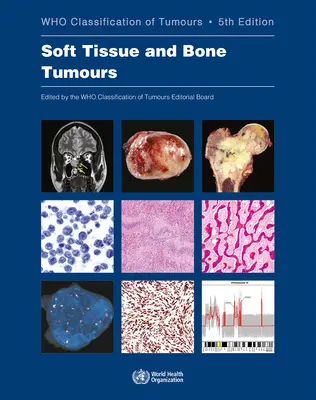 Lágyrész- és csonttumorok: A daganatok osztályozása - Soft Tissue and Bone Tumours: Who Classification of Tumours