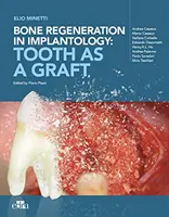 Csontregeneráció az implantológiában - a fog mint graft - Bone regeneration in implantology - tooth as a graft