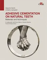 Adhezív cementálás természetes fogakon - Anyagok és technikák - Adhesive cementation on natural teeth - Materials and techniques