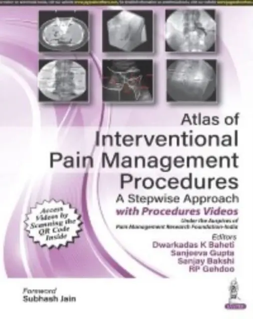 Az intervenciós fájdalomcsillapítási eljárások atlasza - Atlas of Interventional Pain Management Procedures