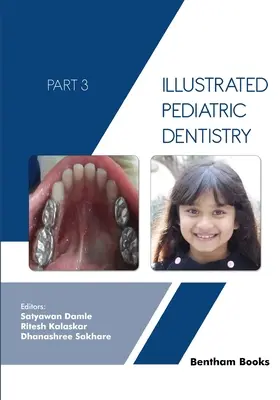 Illusztrált gyermekfogászat - 3. rész - Illustrated Pediatric Dentistry - Part 3