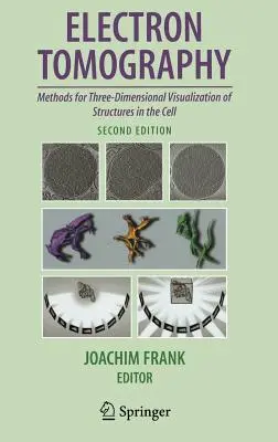 Elektron-tomográfia: A sejtben lévő struktúrák háromdimenziós vizualizációjának módszerei - Electron Tomography: Methods for Three-Dimensional Visualization of Structures in the Cell