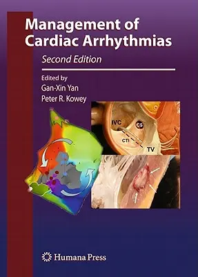A szívritmuszavarok kezelése - Management of Cardiac Arrhythmias