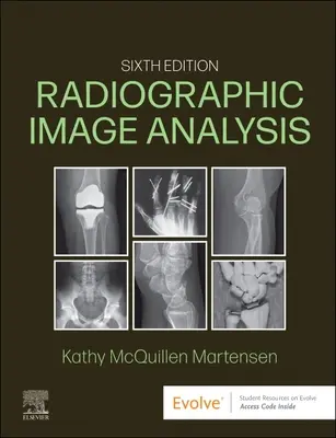 Röntgenfelvételek elemzése - Radiographic Image Analysis