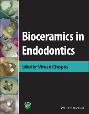 Biokerámia az endodontikában - Bioceramics in Endodontics