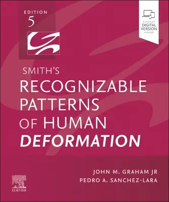 Smith felismerhető mintái az emberi deformációnak - Smith's Recognizable Patterns of Human Deformation