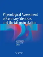 A koszorúér-szűkületek és a mikrokeringés élettani értékelése - Physiological Assessment of Coronary Stenoses and the Microcirculation