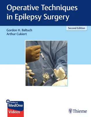 Operatív technikák az epilepsziás sebészetben - Operative Techniques in Epilepsy Surgery