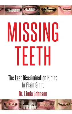 Hiányzó fogak: Az utolsó diszkrimináció, amely a szemünk előtt rejtőzködik - Missing Teeth: The Last Discrimination Hiding in Plain Sight