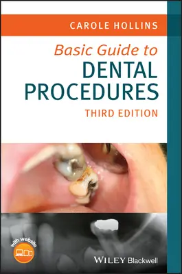 Alapvető útmutató a fogászati eljárásokhoz - Basic Guide to Dental Procedures