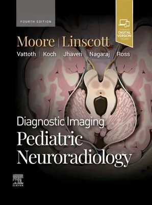 Diagnosztikai képalkotás: Neuroradiológia: Gyermekkori neuroradiológia - Diagnostic Imaging: Pediatric Neuroradiology