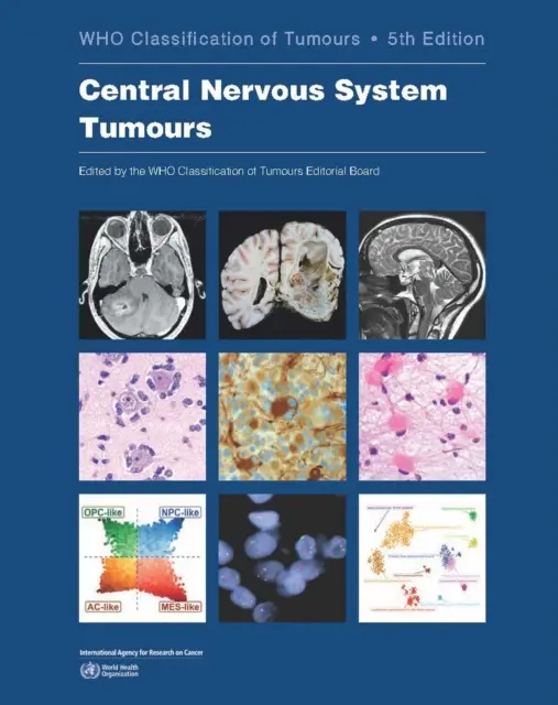 Központi idegrendszeri daganatok: A daganatok osztályozása - Central Nervous System Tumours: Who Classification of Tumours