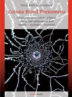 Koronavér-jelenségek: A vér, a szérum és az agy-gerincvelői folyadék mikroszkópos vizsgálata: Egészségesek - Oltottak - Gyógyultak - Corona Blood Phenomena: Microscopic Examinations of Blood, Serum, and Cerebrospinal Fluid: Healthy - Vaccinated - Recovered