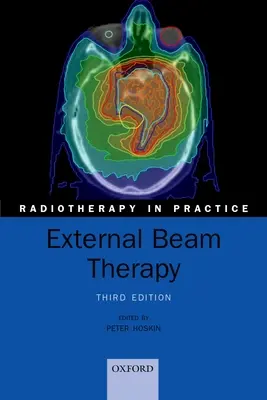 Külső sugárterápia - External Beam Therapy