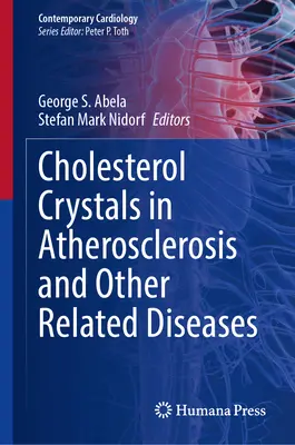 Koleszterinkristályok az ateroszklerózisban és más kapcsolódó betegségekben - Cholesterol Crystals in Atherosclerosis and Other Related Diseases