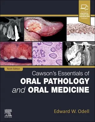 Cawson's Essentials of Oral Pathology and Oral Medicine (A szájüregi patológia és szájgyógyászat alapjai) - Cawson's Essentials of Oral Pathology and Oral Medicine