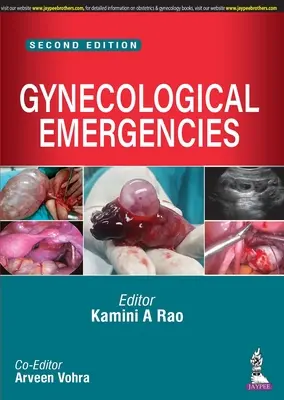 Nőgyógyászati vészhelyzetek - Gynecological Emergencies