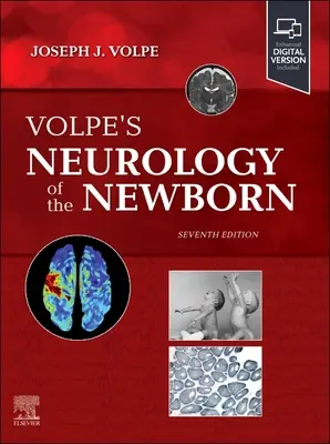 Volpe: Az újszülött neurológiája - Volpe's Neurology of the Newborn