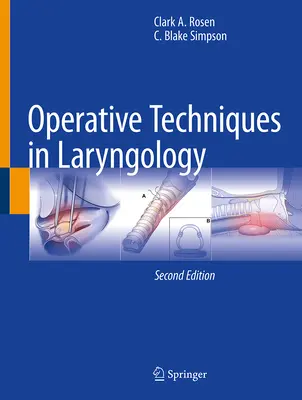 Operatív technikák a gégészetben - Operative Techniques in Laryngology