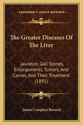 A máj nagyobb betegségei: Sárgaság, epekövek, megnagyobbodások, daganatok és rák, valamint kezelésük - The Greater Diseases Of The Liver: Jaundice, Gall Stones, Enlargements, Tumors, And Cancer, And Their Treatment