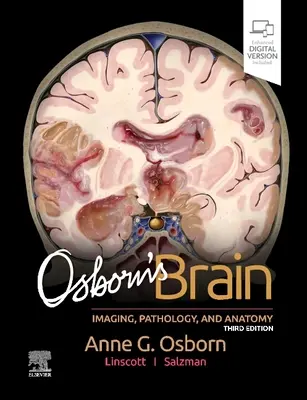 Osborn agya - Osborn's Brain