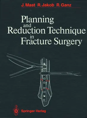 Tervezés és redukciós technika a töréssebészetben - Planning and Reduction Technique in Fracture Surgery