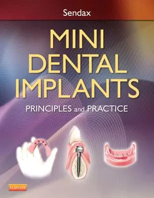 Mini fogászati implantátumok: Alapelvek és gyakorlat - Mini Dental Implants: Principles and Practice
