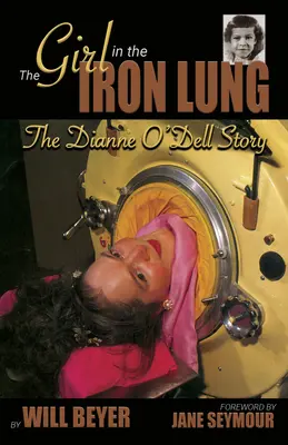 A lány a vastüdőben: Dianne O'Dell története - The Girl in the Iron Lung: The Dianne O'Dell Story