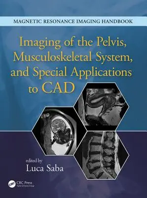 A medence, a mozgásszervi rendszer képalkotása és a CAD speciális alkalmazásai - Imaging of the Pelvis, Musculoskeletal System, and Special Applications to CAD