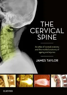 A nyaki gerinc: A normális anatómia és az öregedés és a sérülések kóros anatómiájának atlasza - The Cervical Spine: An Atlas of Normal Anatomy and the Morbid Anatomy of Ageing and Injuries