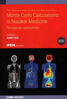 Monte Carlo-számítások a nukleáris medicinában: Terápiás alkalmazások - Monte Carlo Calculations in Nuclear Medicine: Therapeutic Applications