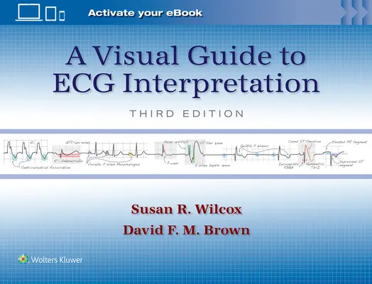 Vizuális útmutató az EKG-értelmezéshez - A Visual Guide to ECG Interpretation