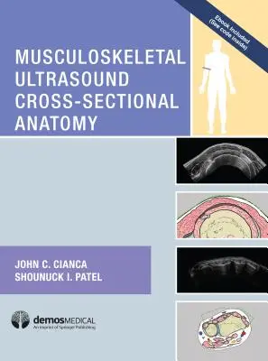 Mozgásszervi ultrahang keresztmetszeti anatómia - Musculoskeletal Ultrasound Cross-Sectional Anatomy