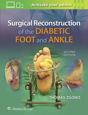 A diabéteszes láb és boka sebészeti rekonstrukciója - Surgical Reconstruction of the Diabetic Foot and Ankle