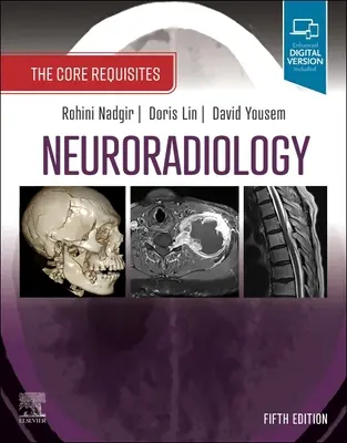 Neuroradiológia: Az alapvető követelmények - Neuroradiology: The Core Requisites