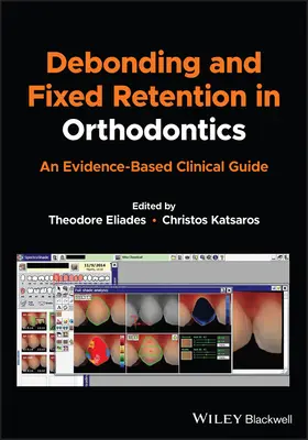 Debonding és fix retentio a fogszabályozásban: A bizonyítékokon alapuló klinikai útmutató - Debonding and Fixed Retention in Orthodontics: An Evidence-Based Clinical Guide