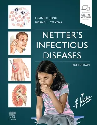 Netter fertőző betegségei - Netter's Infectious Diseases