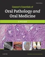 Cawson's Essentials of Oral Pathology and Oral Medicine (A szájüregi patológia és szájgyógyászat alapjai) - Cawson's Essentials of Oral Pathology and Oral Medicine