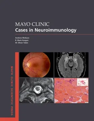 A Mayo Klinika esetei a neuroimmunológiában - Mayo Clinic Cases in Neuroimmunology