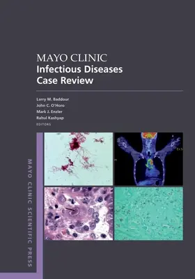 A Mayo Klinika fertőző betegségek esetismertetése: Igazgatótanácsi kérdésekkel és válaszokkal - Mayo Clinic Infectious Disease Case Review: With Board-Style Questions and Answers