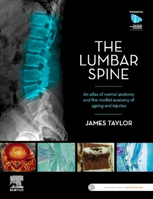 Az ágyéki gerinc: Az öregedés és a sérülések kóros anatómiája: A normál anatómia és a sérülések atlasza - The Lumbar Spine: An Atlas of Normal Anatomy and the Morbid Anatomy of Ageing and Injury