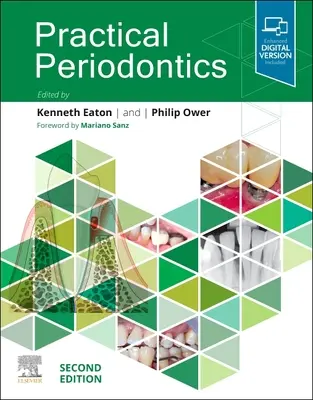 Gyakorlati parodontológia - Practical Periodontics