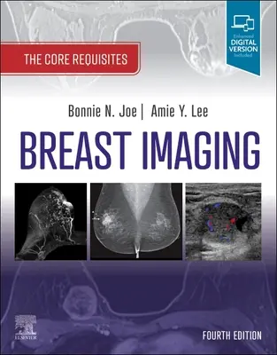 Breast Imaging: Az alapvető követelmények - Breast Imaging: The Core Requisites