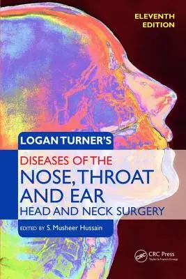 Logan Turner: Az orr, torok és fül betegségei, fej- és nyaksebészet: Fej- és nyaksebészet, 11. kiadás - Logan Turner's Diseases of the Nose, Throat and Ear, Head and Neck Surgery: Head and Neck Surgery, 11th Edition