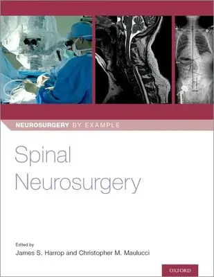 Gerincvelői idegsebészet - Spinal Neurosurgery